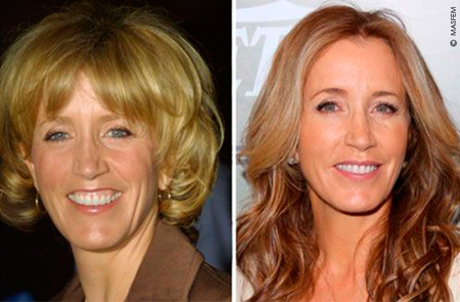 Ромбовидное лицо Ромбовидное лицо