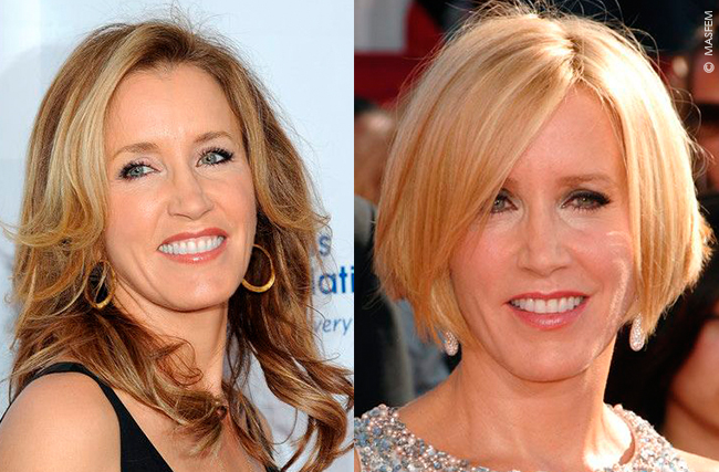 Ромбовидное лицо Ромбовидное лицо