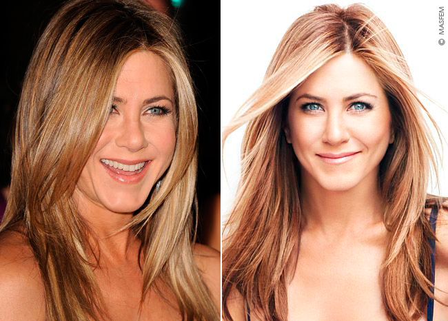 Ромбовидное лицо Ромбовидное лицо