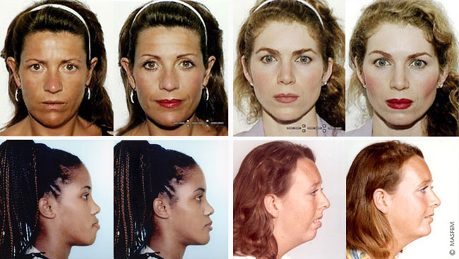 На сколько лицо соответствует идеальным пропорциям На сколько лицо соответствует идеальным пропорциям